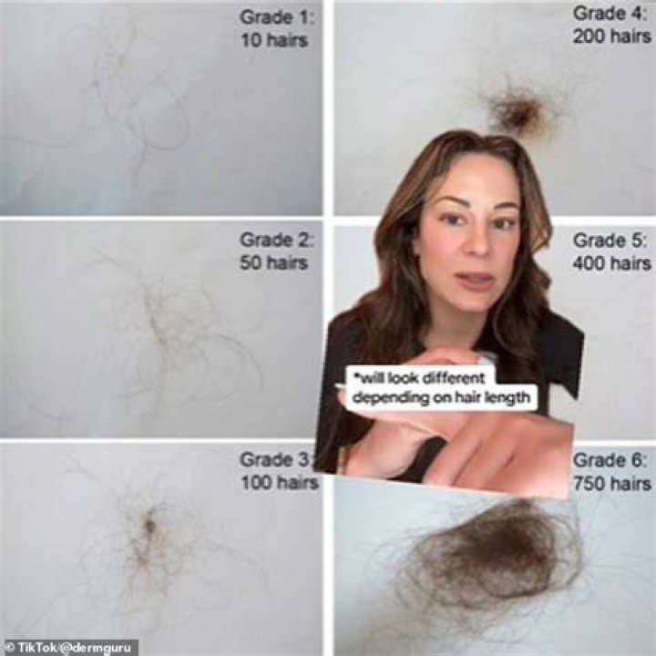 Is hair on your head dead?