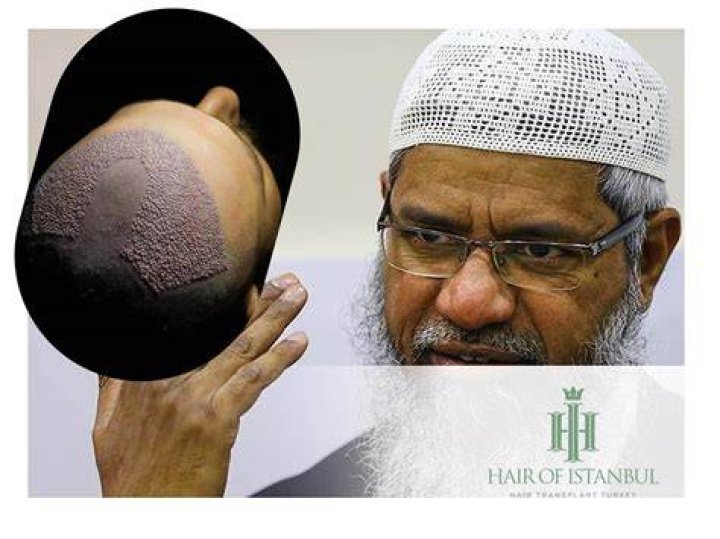 Is it haram to have armpit hair?