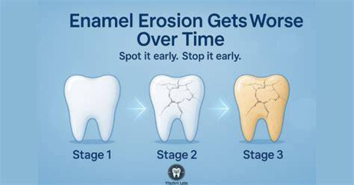 Is it possible to build back enamel?