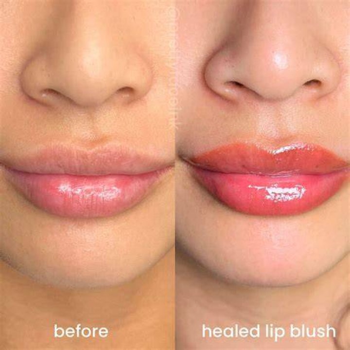 Is lip blushing worth it?