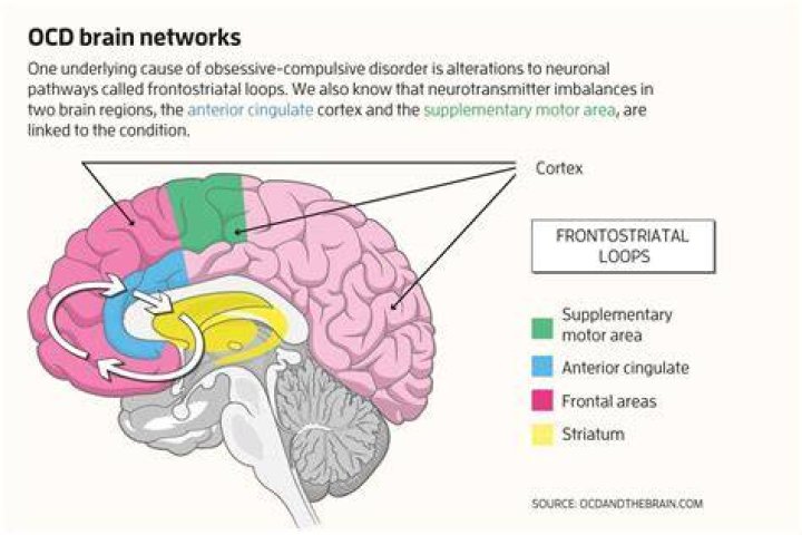 Is OCD a brain disorder?