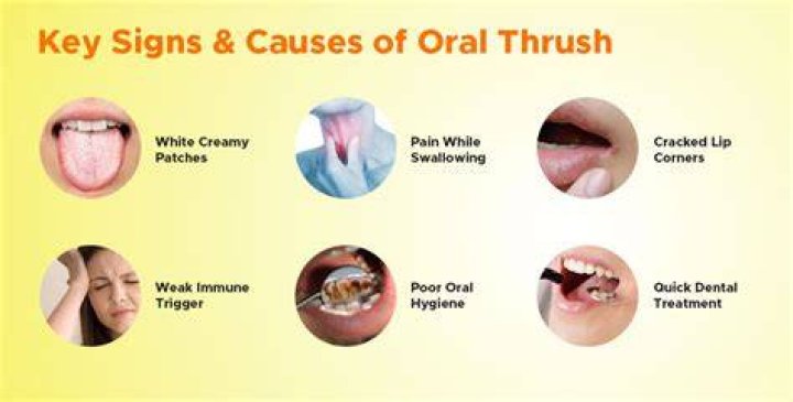 Is oral thrush painful?