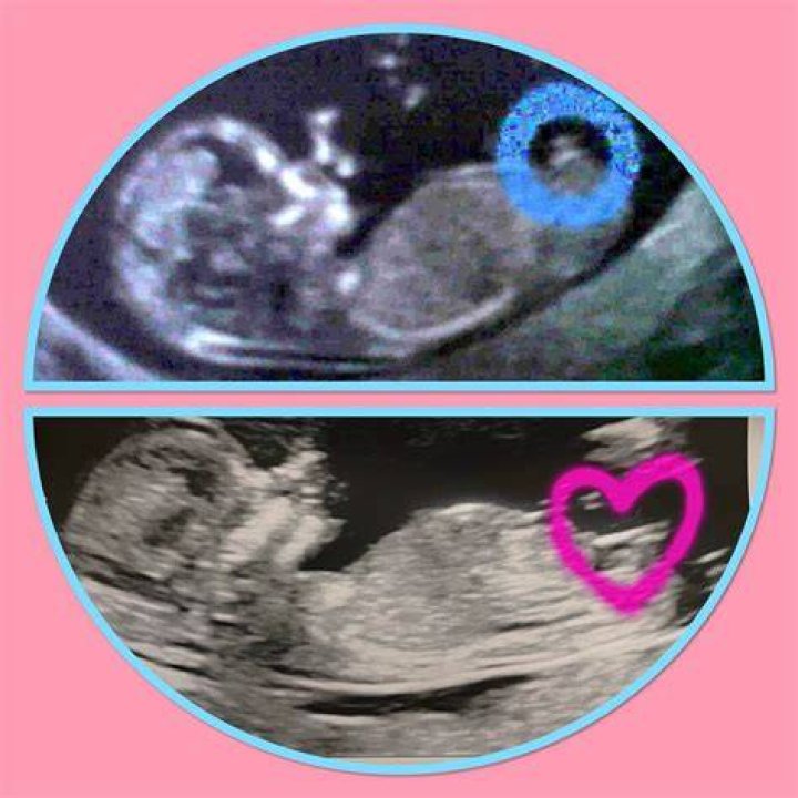 Is princess a boy or girl?