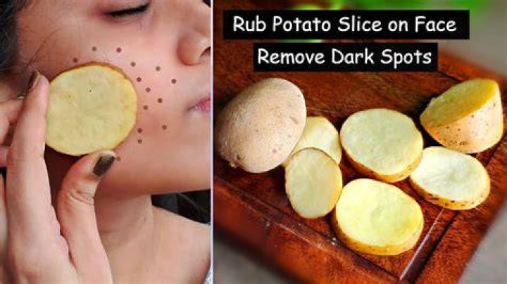 Is rubbing raw potatoes on your face good?