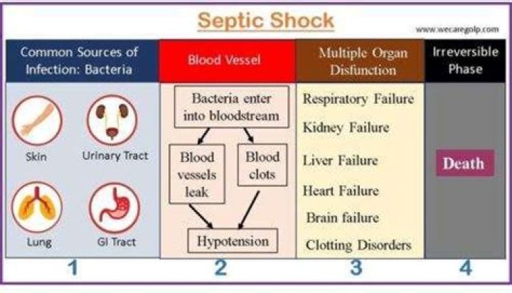 Is septic shock caused by stress?