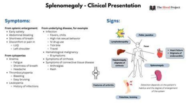 Is splenomegaly curable?