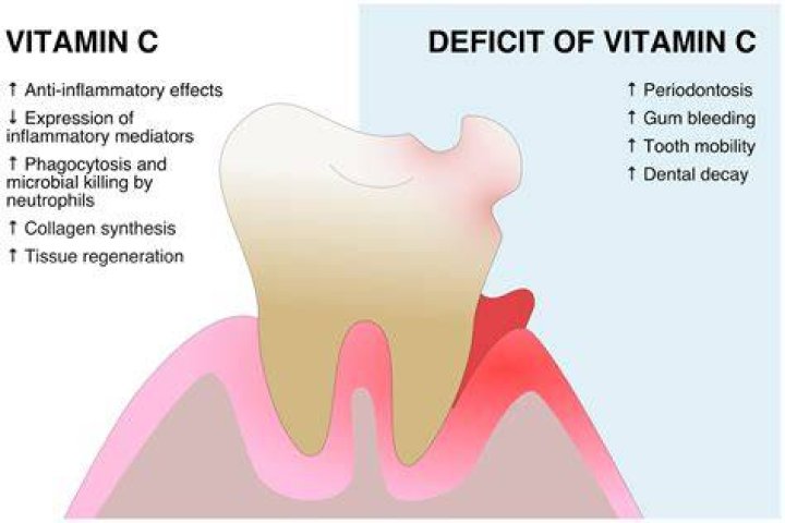 Is vitamin C anti inflammatory?