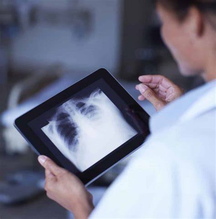 Is XRAY free in Canada?