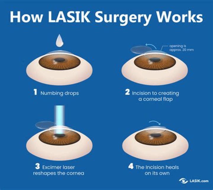 Should I be scared for LASIK?