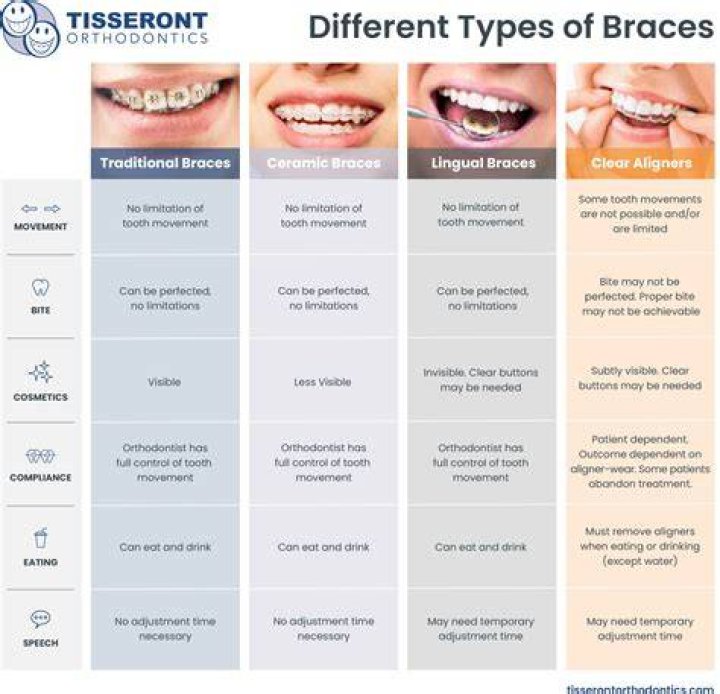 Should I get braces at 28?