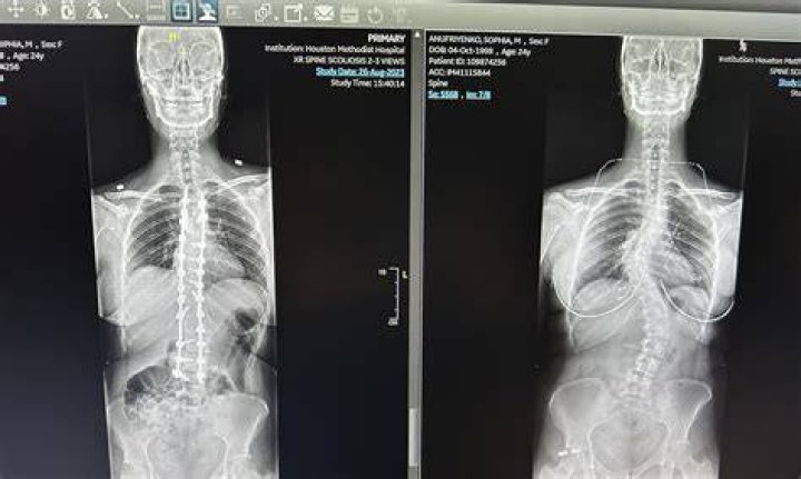 Should I shower before an MRI?