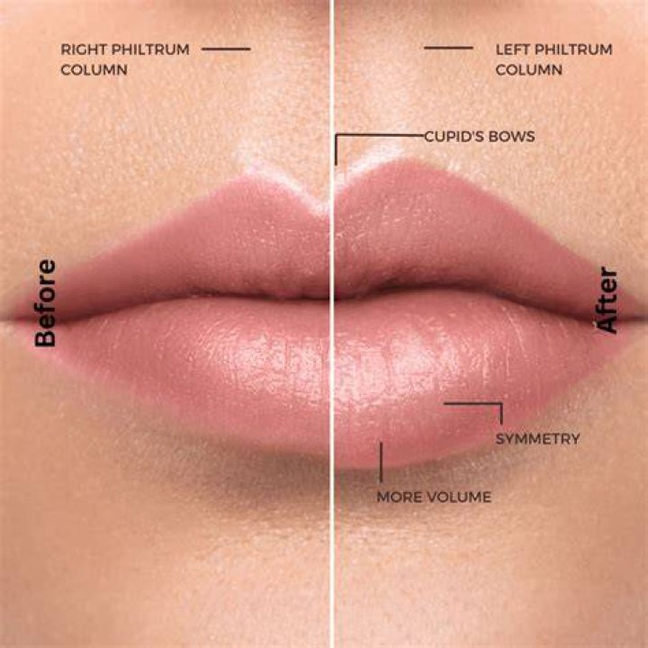 What are M lips?
