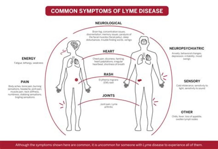What are neurological symptoms of Lyme disease?