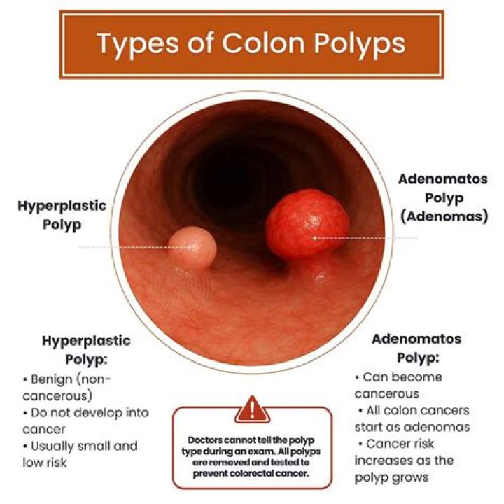 What are polyps caused from?