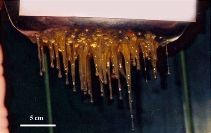 What are rope worms in humans?