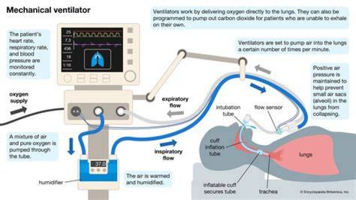 What are the chances of coming off ventilator with COVID?