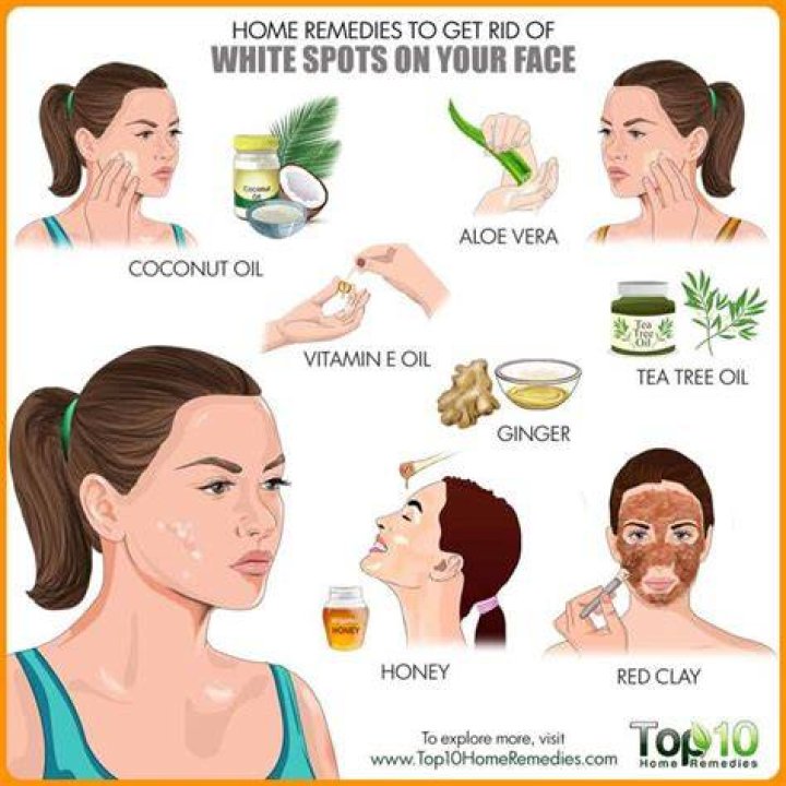 What are the home remedies for white patches on face?