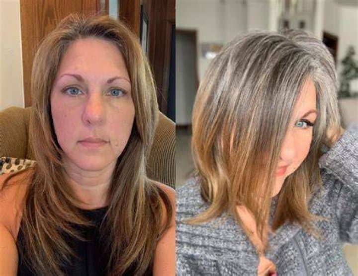 What are the stages of going grey?