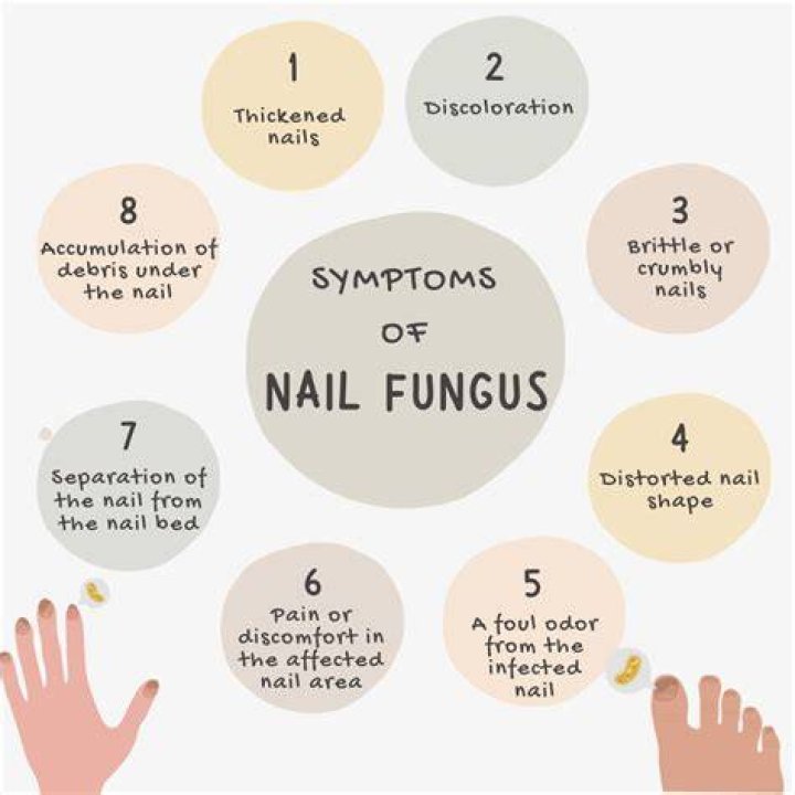 What are the symptoms of fungus in the body?
