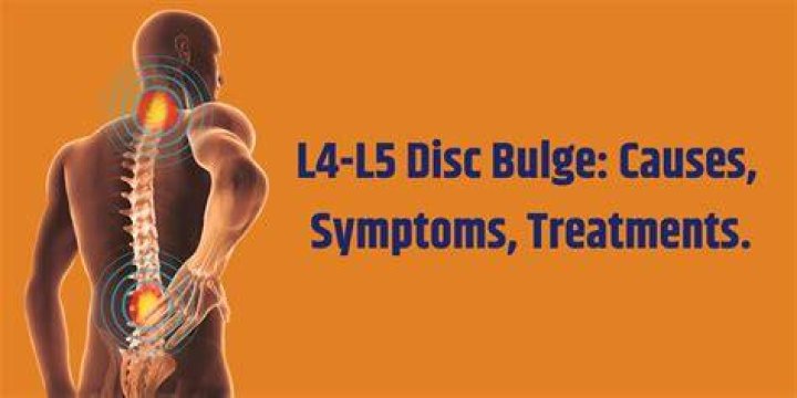 What are the symptoms of L4 nerve damage?