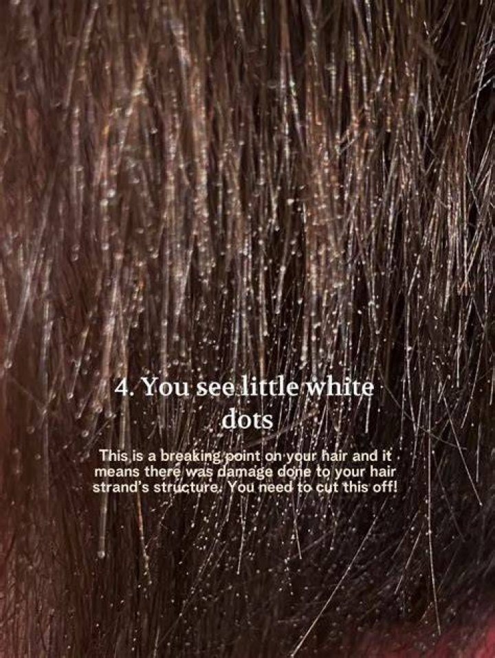 What are these white rocks in my hair?