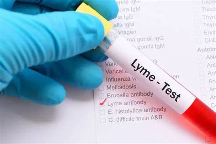 What blood test results indicate lymphoma?