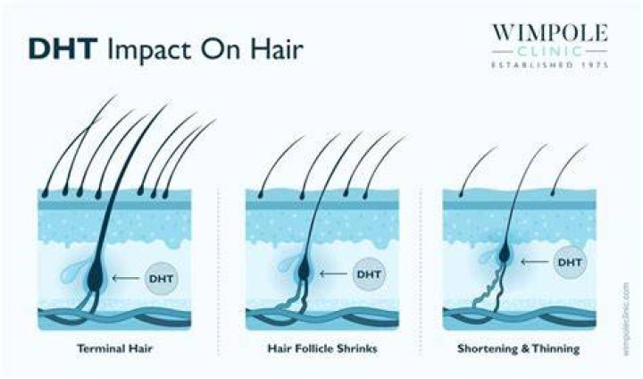 What causes dead hair follicles?