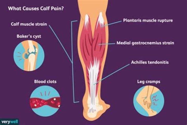 What causes severe muscle pain in both legs and arms?
