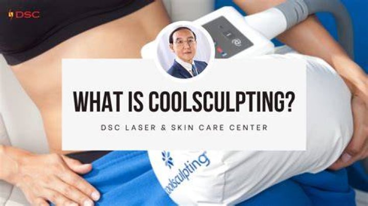 What celebrities use CoolSculpting?