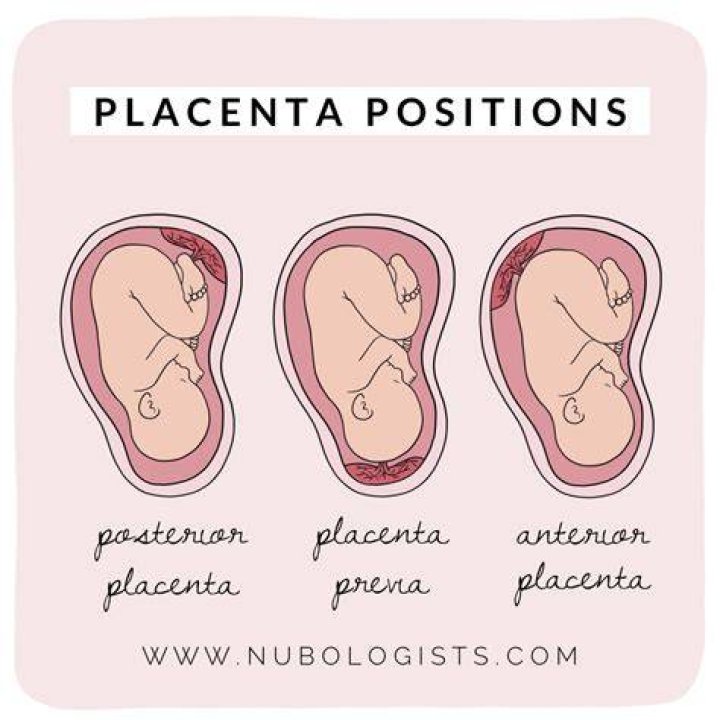 What do doctors do with your placenta?
