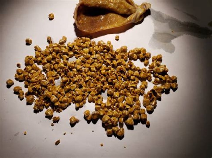 What do gallstones look like in poop?