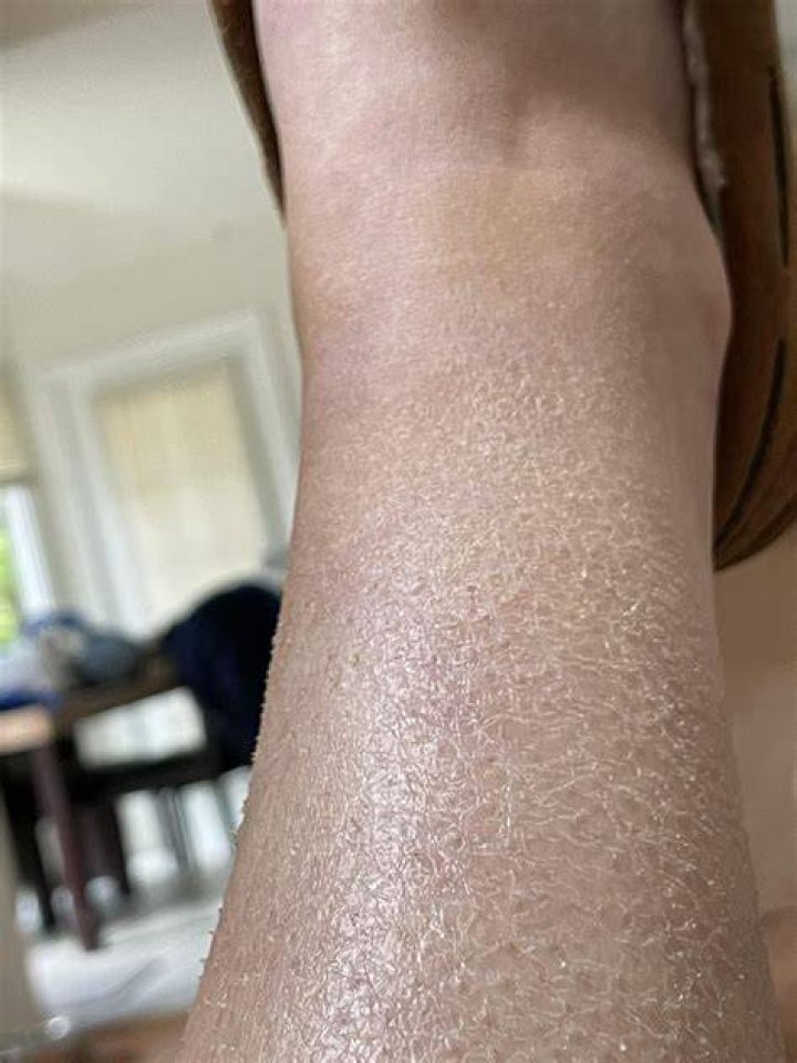 What do shiny legs mean?
