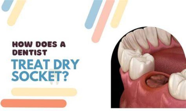 What does a dry socket look like?