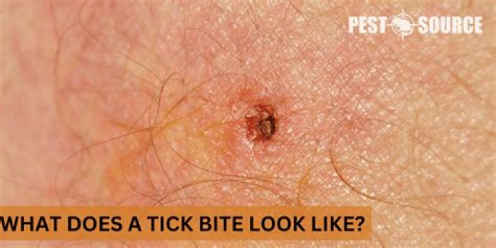 What does a tick bite look like?