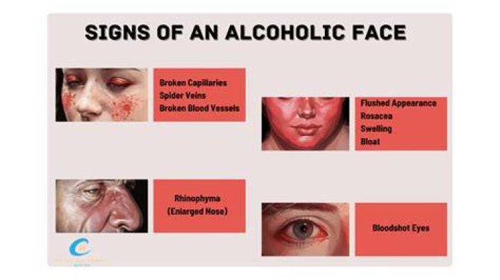 What does alcoholism look like in a person?