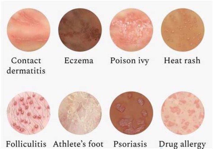 What does an allergy rash look like?