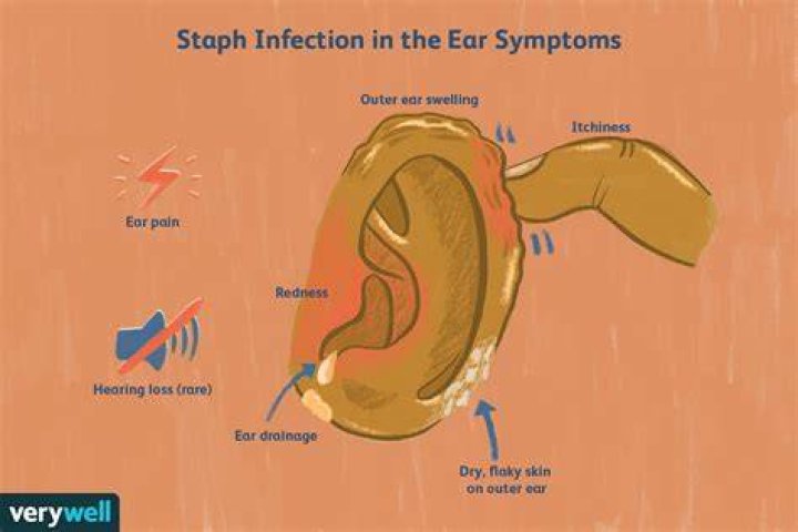 What does an ear infection smell like?