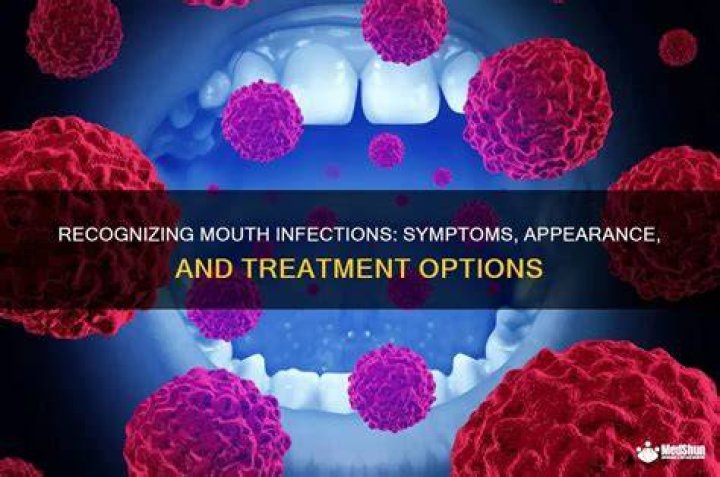 What does an infection in the mouth feel like?