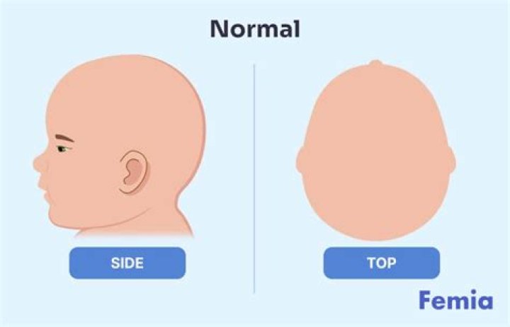 What does baby O face mean?