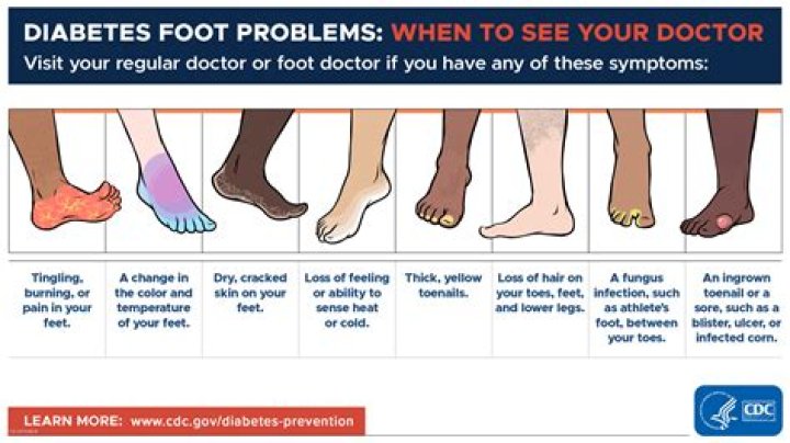 What does diabetes do to your toes?