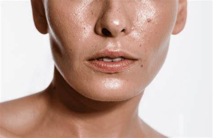 What does oily skin look like?