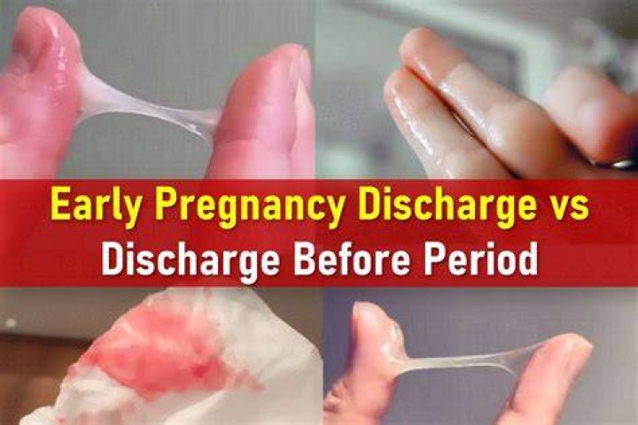 What does re 4 discharge mean?