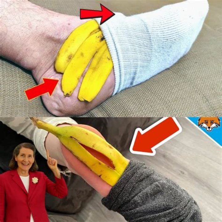 What does rubbing a banana peel on your feet do?