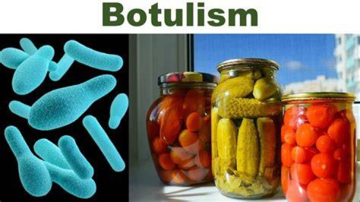 What foods can botulism be found in?