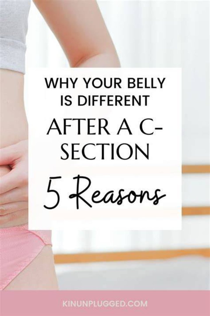 What happens if you sneeze after C-section?