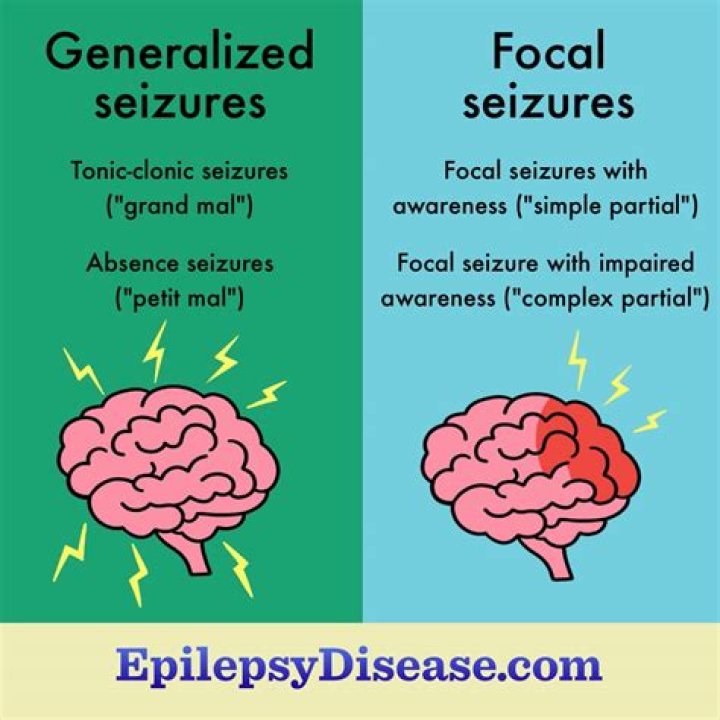 What is a focal seizure?