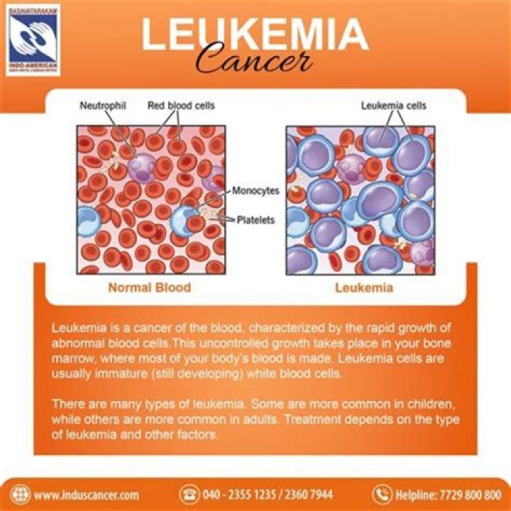 What is end stage leukemia?