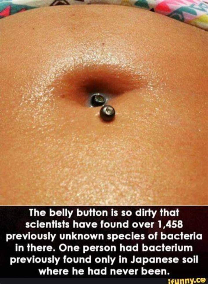 What is the black thing in my belly button?