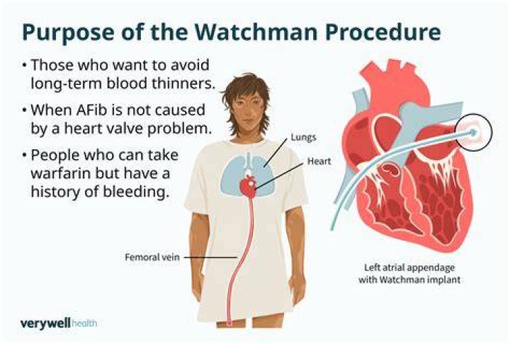 What is the job of a watchman class 6?