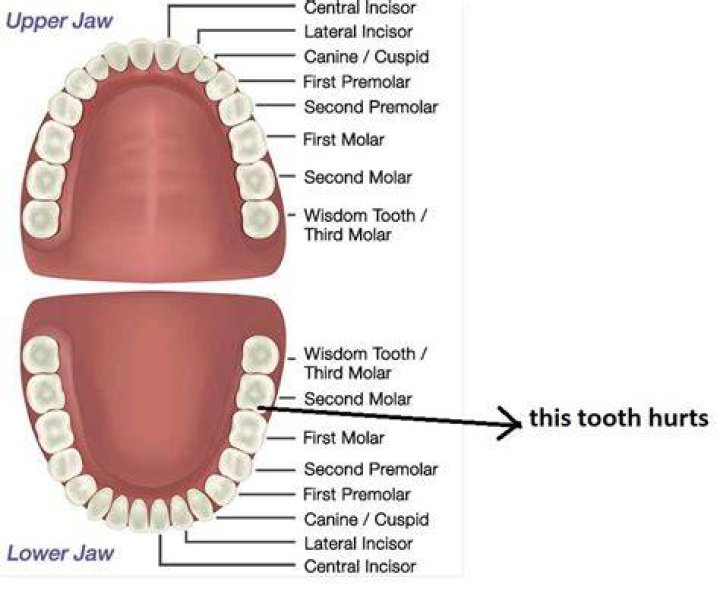 What is the last teeth called?